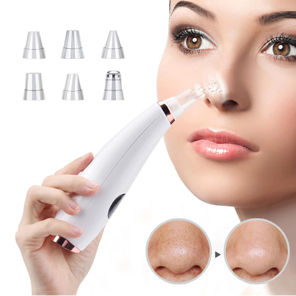 Deep Cleansing Pore Vacuum