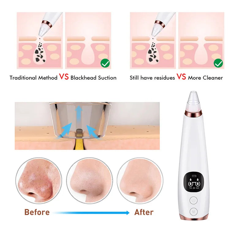 Deep Cleansing Pore Vacuum