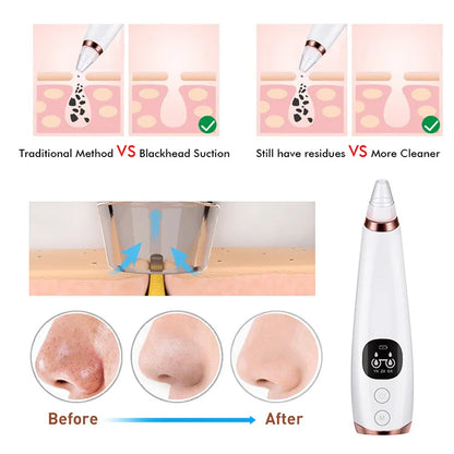 Deep Cleansing Pore Vacuum