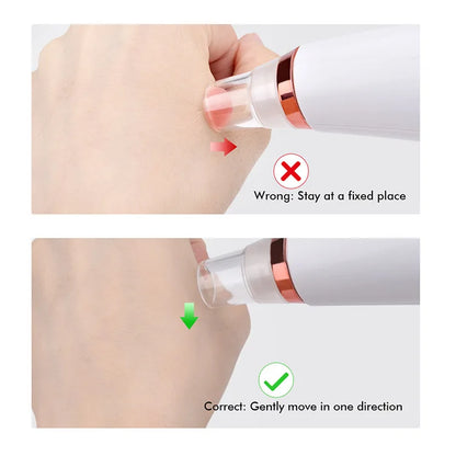 Deep Cleansing Pore Vacuum