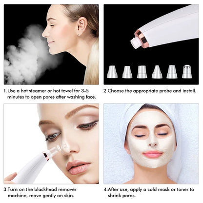 Deep Cleansing Pore Vacuum